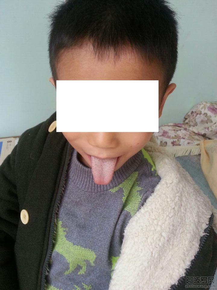 症状孩子舌苔_1.jpg
